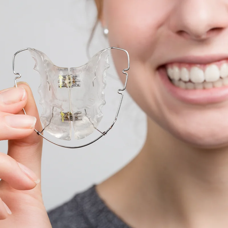 Lose Zahnspange Euskirchen Lose Zahnspange Euskirchen